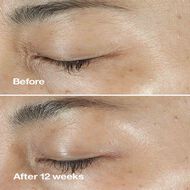 faces clinique smart clinical repair wrinkle correcting serum