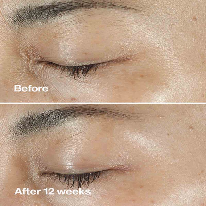 clinique clinique smart clinical repair wrinkle correcting serum