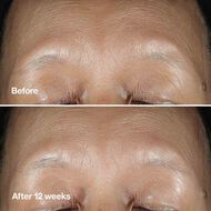 faces clinique smart clinical repair wrinkle correcting serum