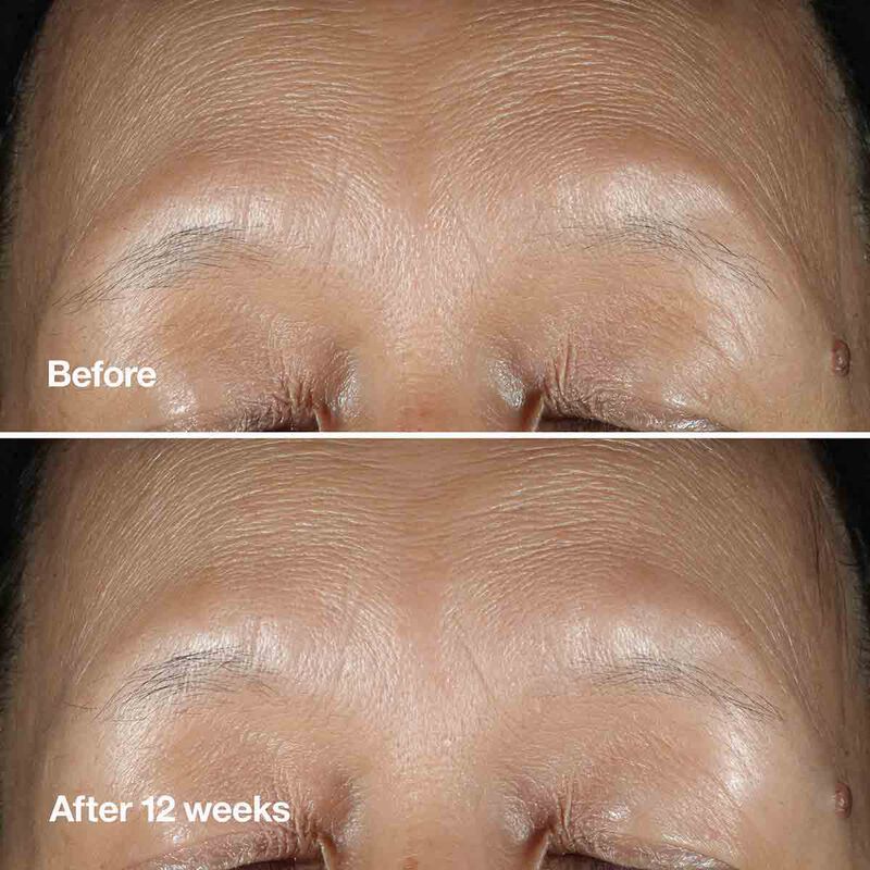 clinique clinique smart clinical repair wrinkle correcting serum