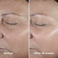 faces clinique smart clinical repair wrinkle correcting serum