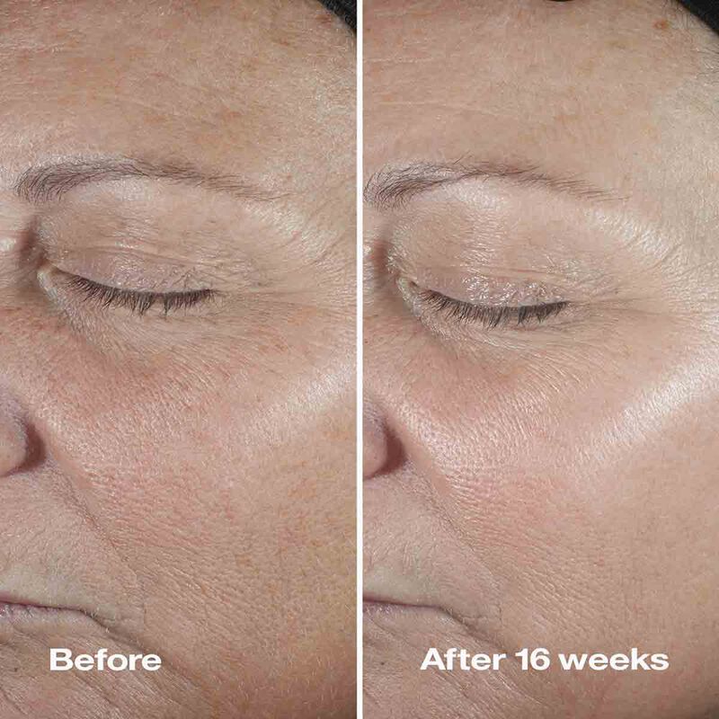 clinique clinique smart clinical repair wrinkle correcting serum