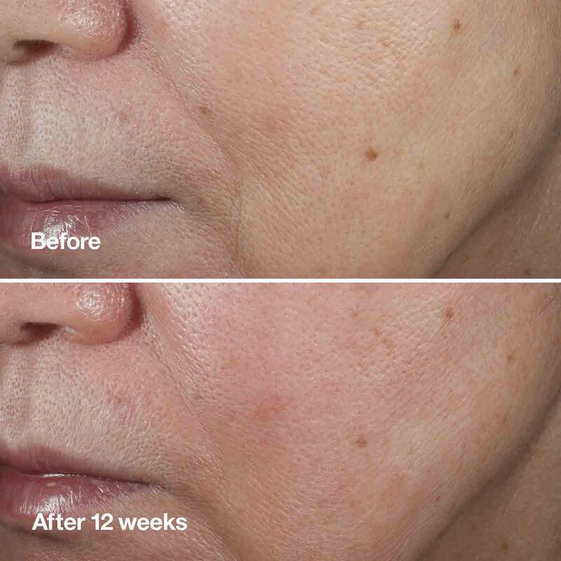 clinique clinique smart clinical repair wrinkle correcting serum